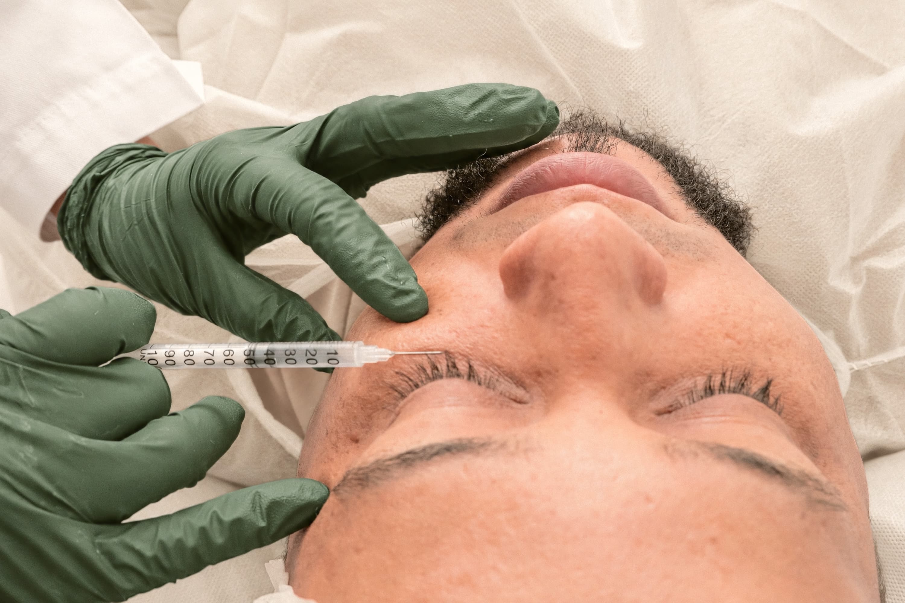 Botox for men: dosing, areas, and what to expect
