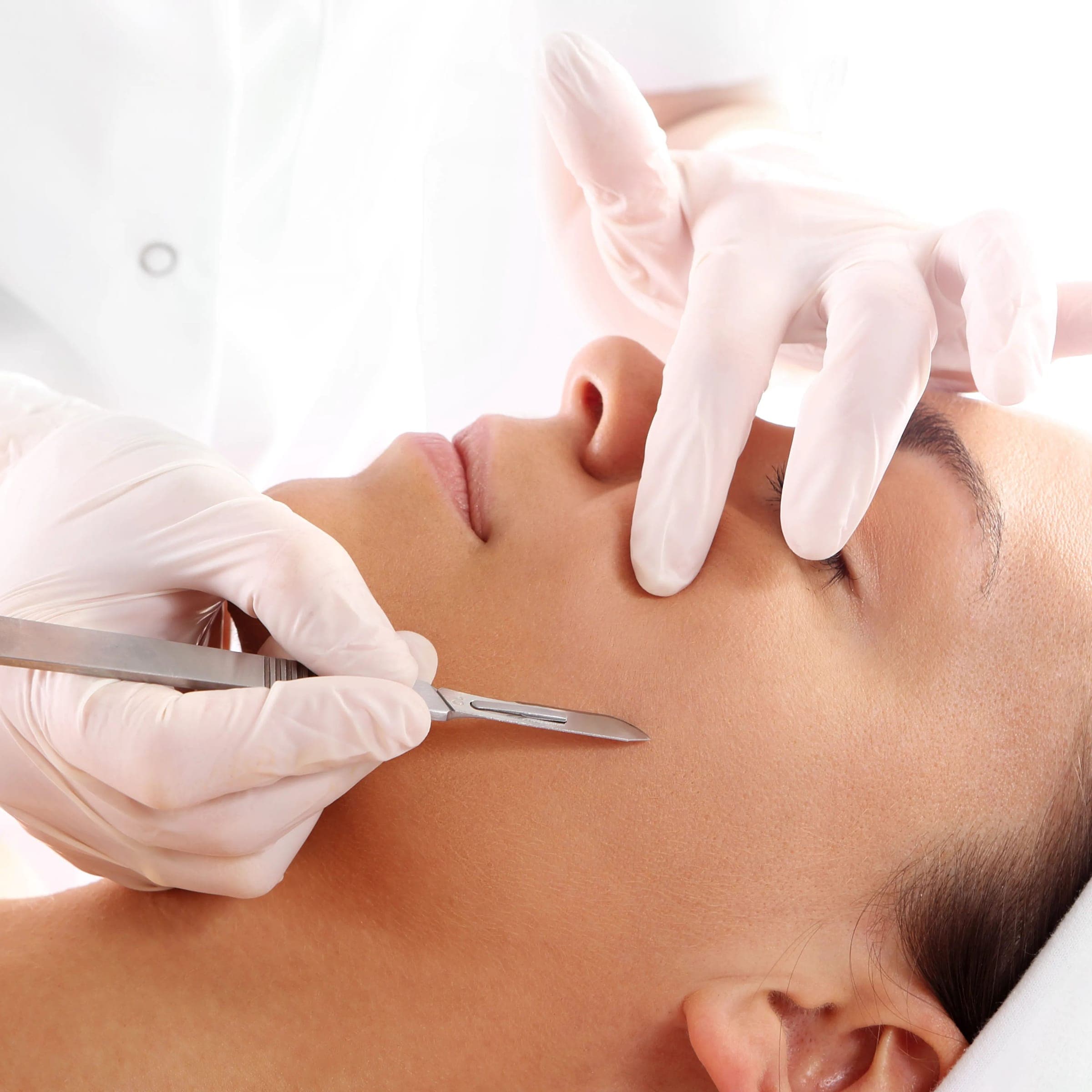 Dermaplane Facial